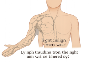 lymph traveling from the right arm will be filtered by: